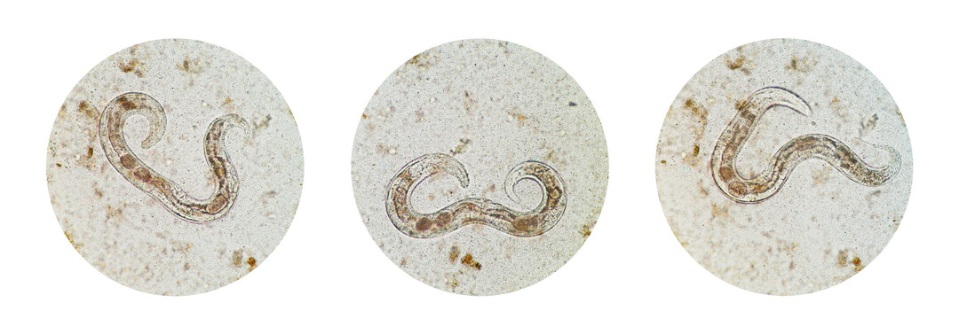<i>Strongyloides stercoralis</i>
, ein pathogener parasit�rer Fadenwurm, der die Krankheit Strongyloidiasis verursacht.