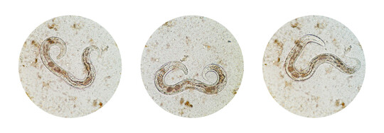 <i>Strongyloides stercoralis</i>
, ein pathogener parasit�rer Fadenwurm, der die Krankheit Strongyloidiasis verursacht.