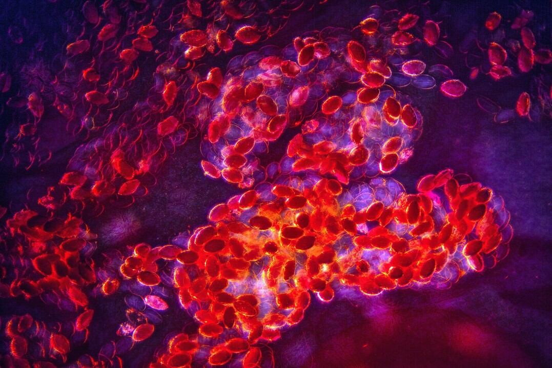 Fasciola hepatica (Leberegel) Eier - 100-fach vergrößert
